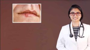 জ্বর-ঠোসা বারবার ফিরে আসে কেন? কারণ ও করণীয়